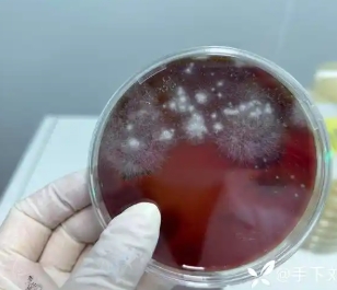 其他微生物菌落检测