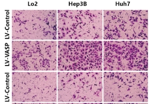 Transwell检测细胞迁移